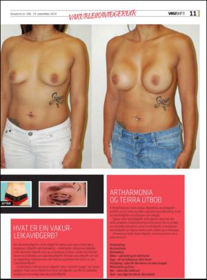 sosialurin_bilag-20140918_000_00_00_011.pdf